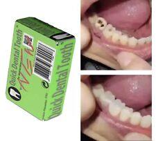 Prótesis dental provisional relleno dental Quick Dental Tooth